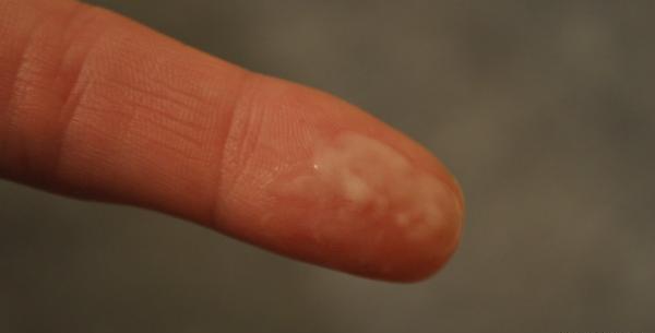 عکس رنگ ترشحات بارداری