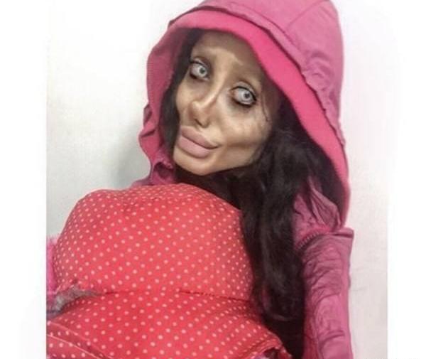 عکس قبل جراحی سحر تبر