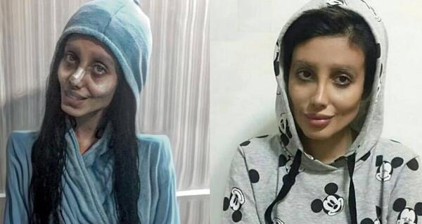 عکس قبل جراحی سحر تبر