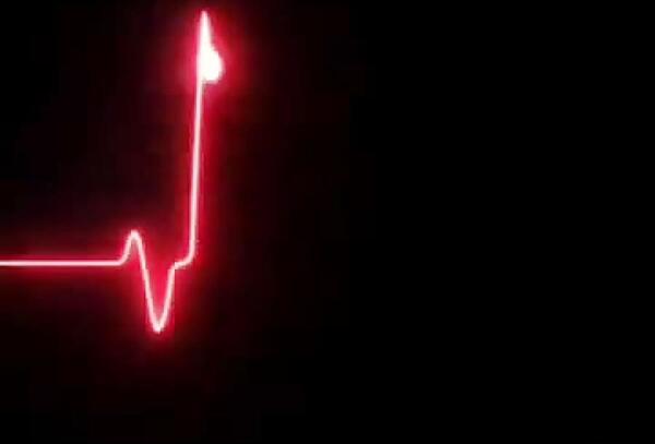 عکس ضربان قلب مردن