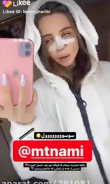 عکس نیکا فلاحی بعد از عمل زیبایی