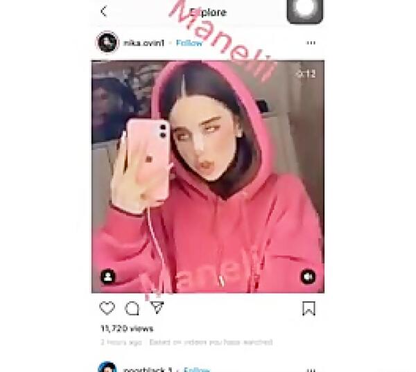 عکس نیکا فلاحی بعد از عمل زیبایی