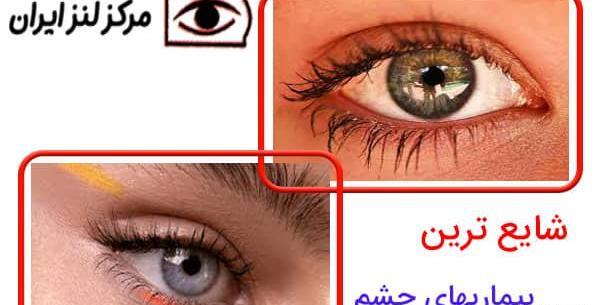 عکس چشم یک