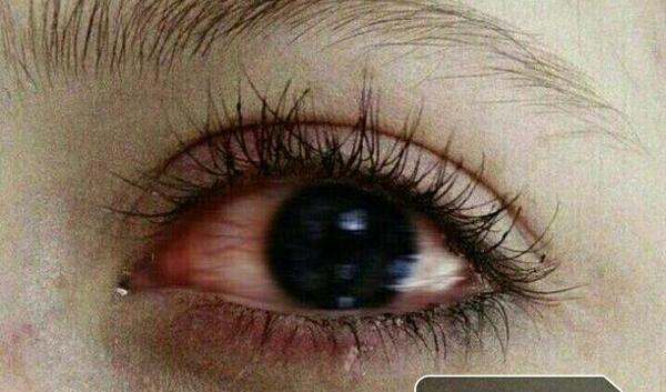 عکس چشم کبود