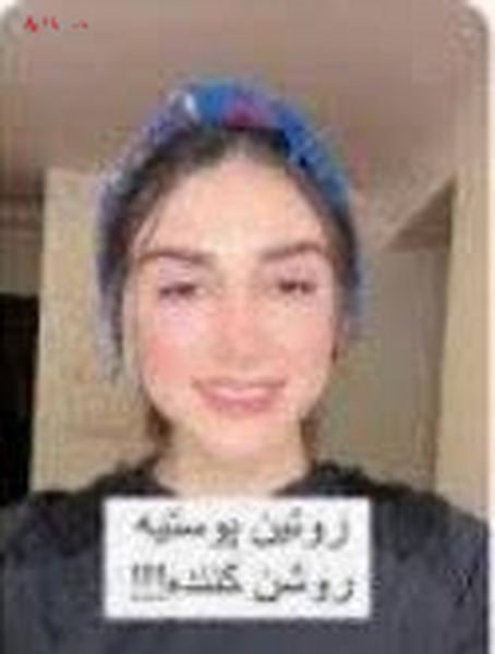 عکس خانم طلا