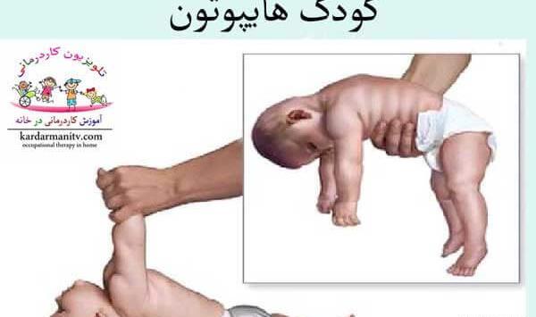 عکس بچه های فلج مغزی