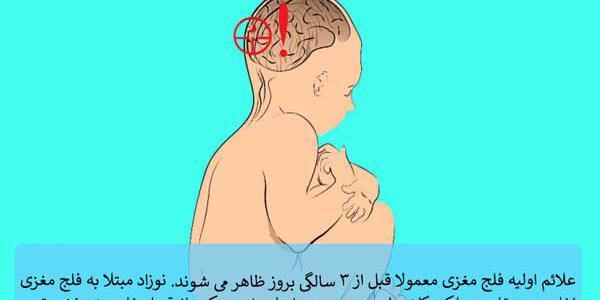 عکس بچه های فلج مغزی