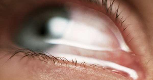 عکس از چشم های گریان