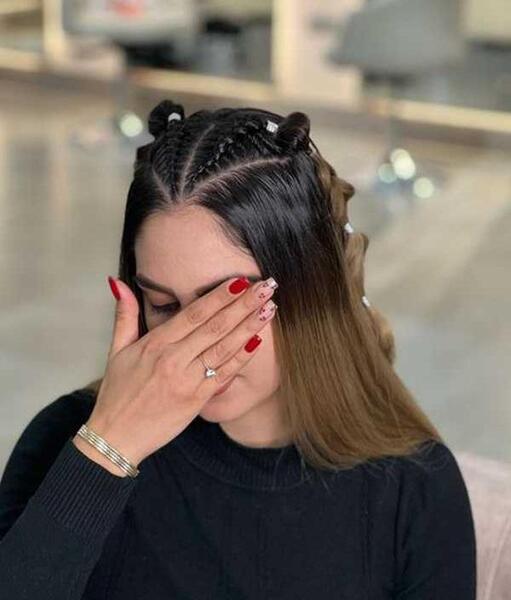عکس بافت جلو سر
