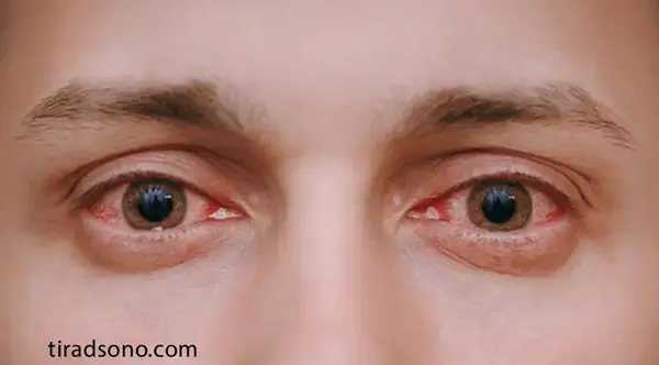 عکس چشم اشکی