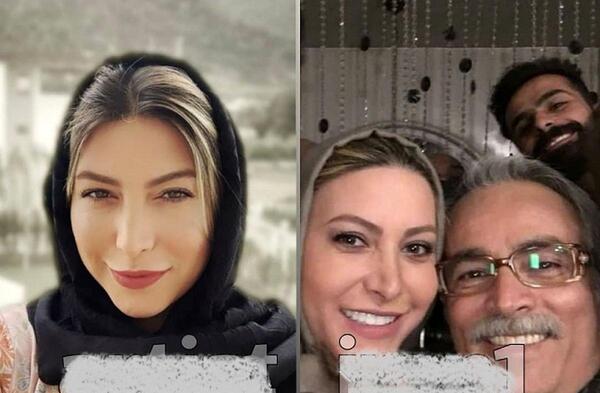 عکس قبل عمل فریبا نادری