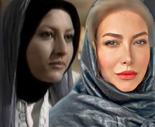 عکس قبل عمل فریبا نادری