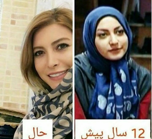 عکس قبل عمل فریبا نادری