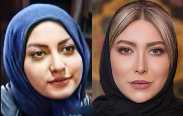 عکس قبل عمل فریبا نادری