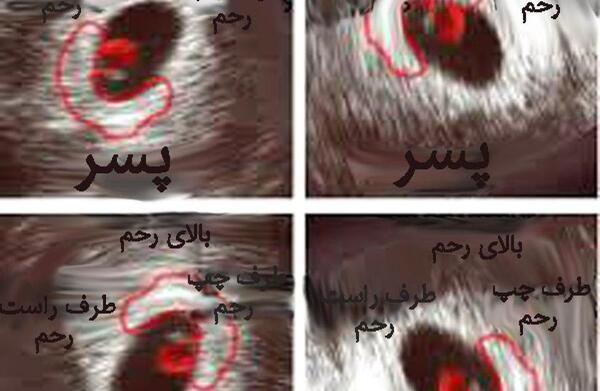 عکس واقعی ضربان قلب