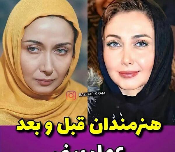 عکس سهیلا گلزار قبل از عمل زیبایی