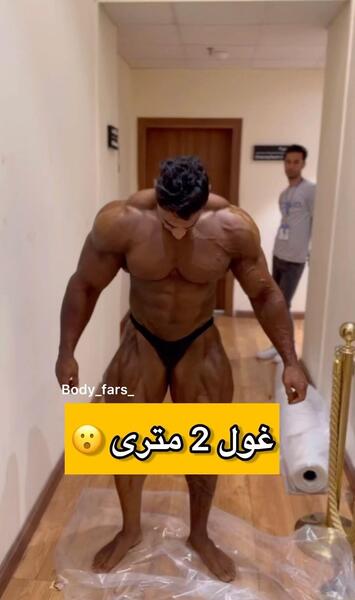 عکس سهیلا گلزار قبل از عمل زیبایی
