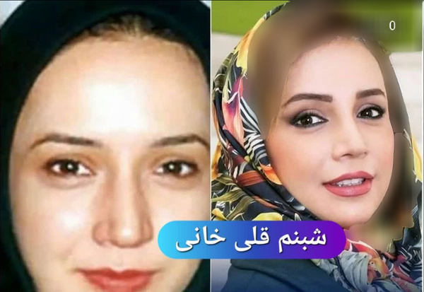 عکس سیما تیرانداز قبل از عمل