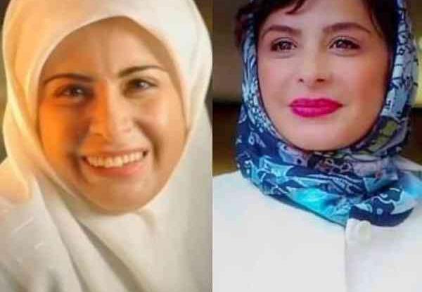 عکس سیما تیرانداز قبل از عمل