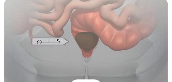عکس توی شکم انسان