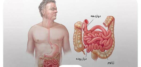عکس توی شکم انسان