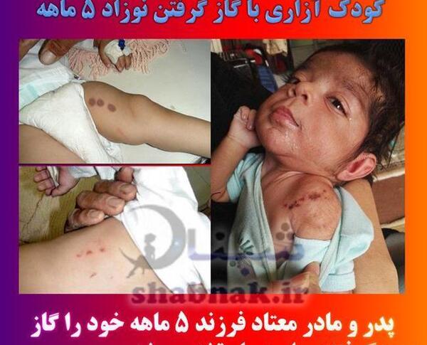 عکس گاز گرفتن دوست پسر