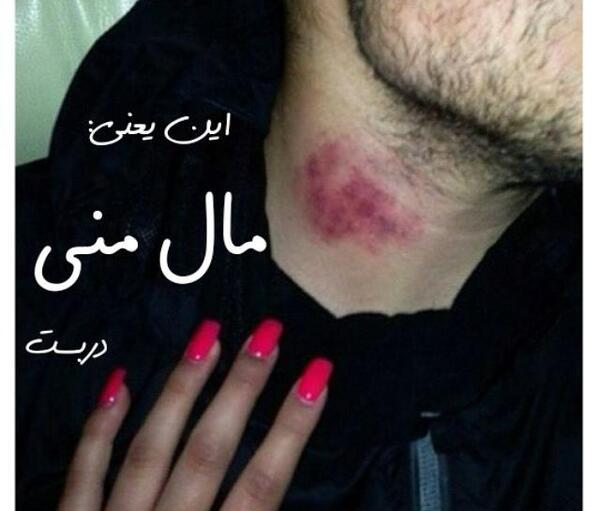 عکس گاز گرفتن دوست پسر