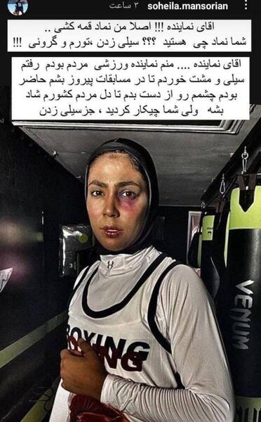 عکس خنده دار هلیا قمه کش