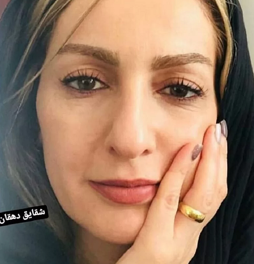 عکسهای لو رفته شقایق دهقان