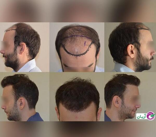 عکس کاشت تره