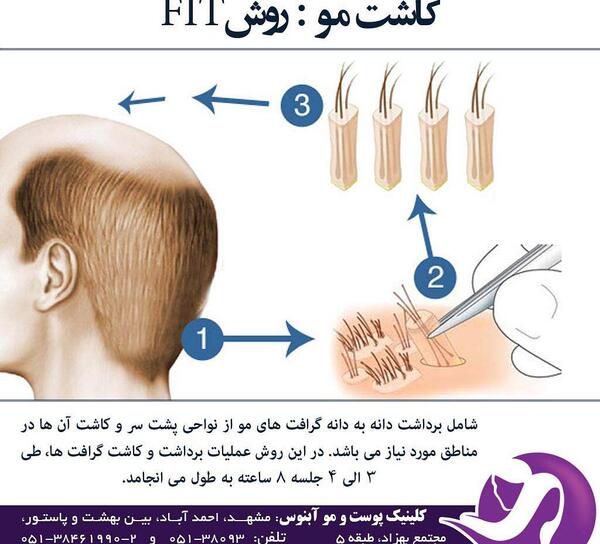 عکس کاشت تره