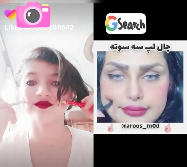 عکس کاشت چال گونه