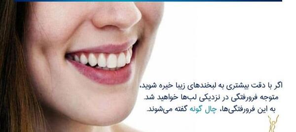 عکس کاشت چال گونه