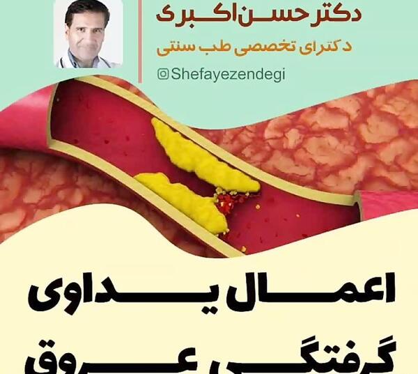 عکس کاشت چال گونه