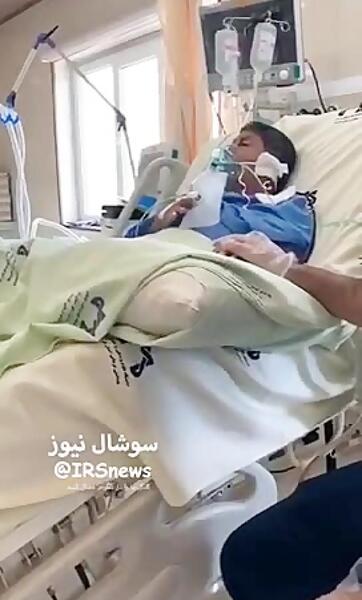 عکس سرم دست دختر بچه