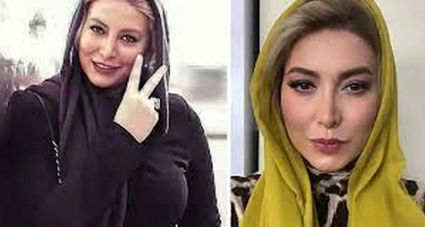 عکس فریبا نادری قبل از عمل زیبایی