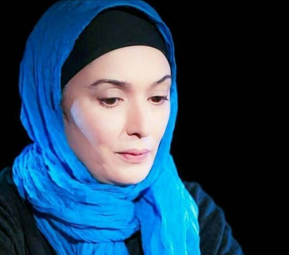 عکس مریضی اتنه فقیه نصیری
