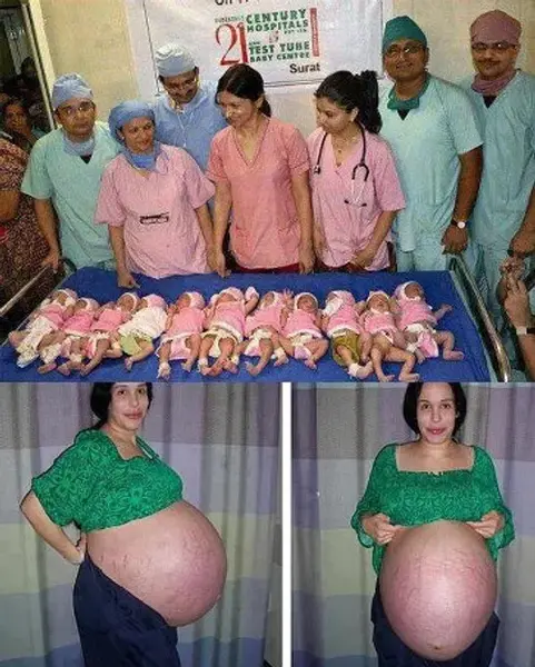 عکس توی شکم