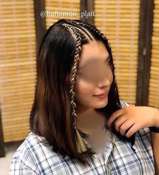 عکس بافت فرق وسط