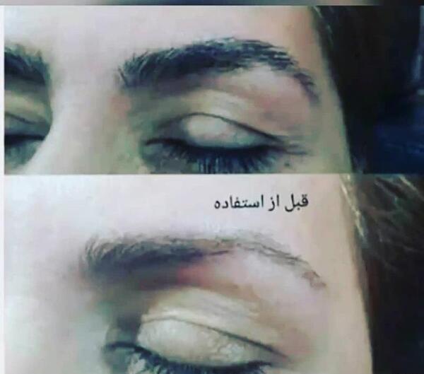 عکس تونیک ابرو لدورا