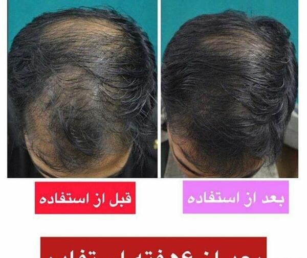 عکس تونیک ابرو لدورا