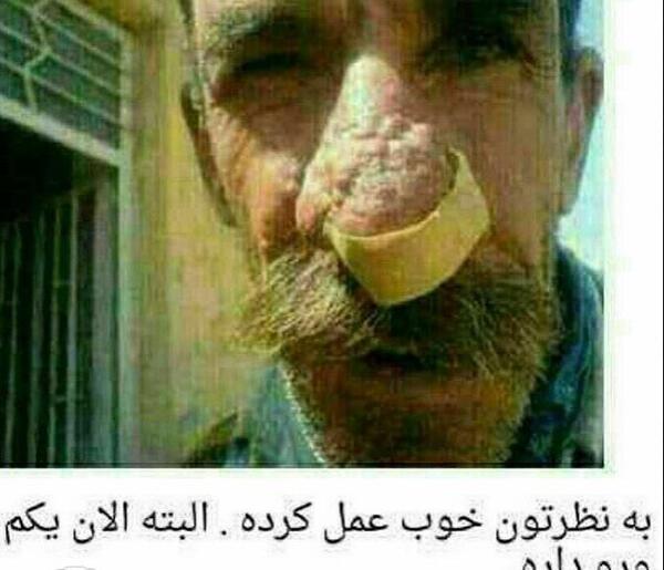 عکس خنده دار حجابی