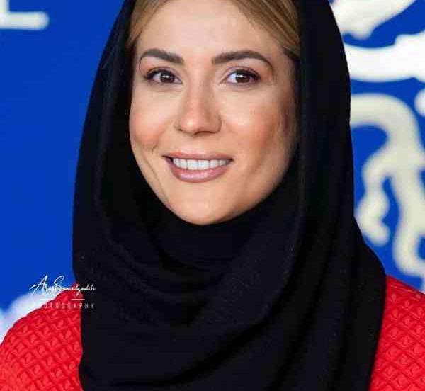 عکس سارا بهرامی بعد از عمل بینی