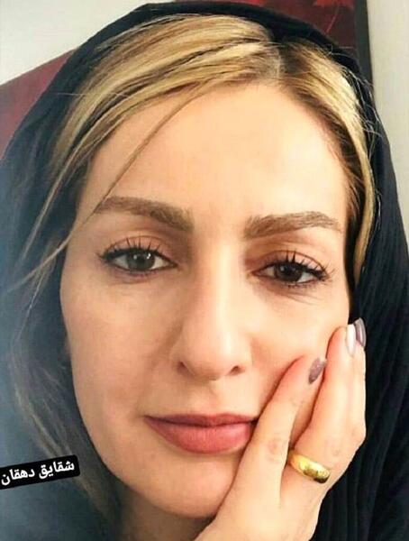 عکس دختر شقایق دهقان نیروانا