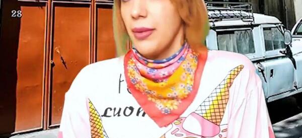 عکس قبل از عمل پارمیدا ممقانی