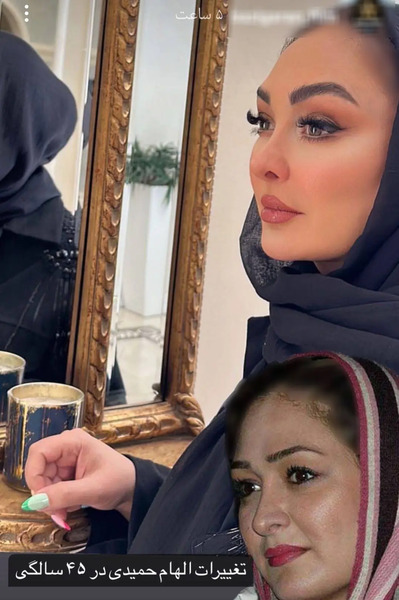 عکس الهام حمیدی