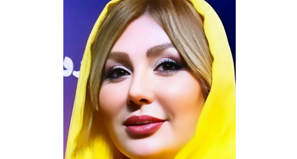 عکس لب تزریق ژل