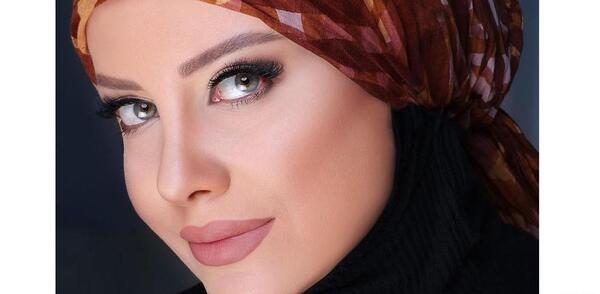 عکس لب تزریق ژل