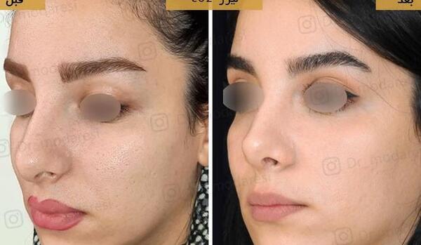 عکس طالبان فراه