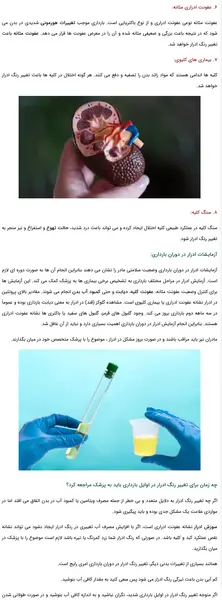 عکس رنگ ادرار در بارداری